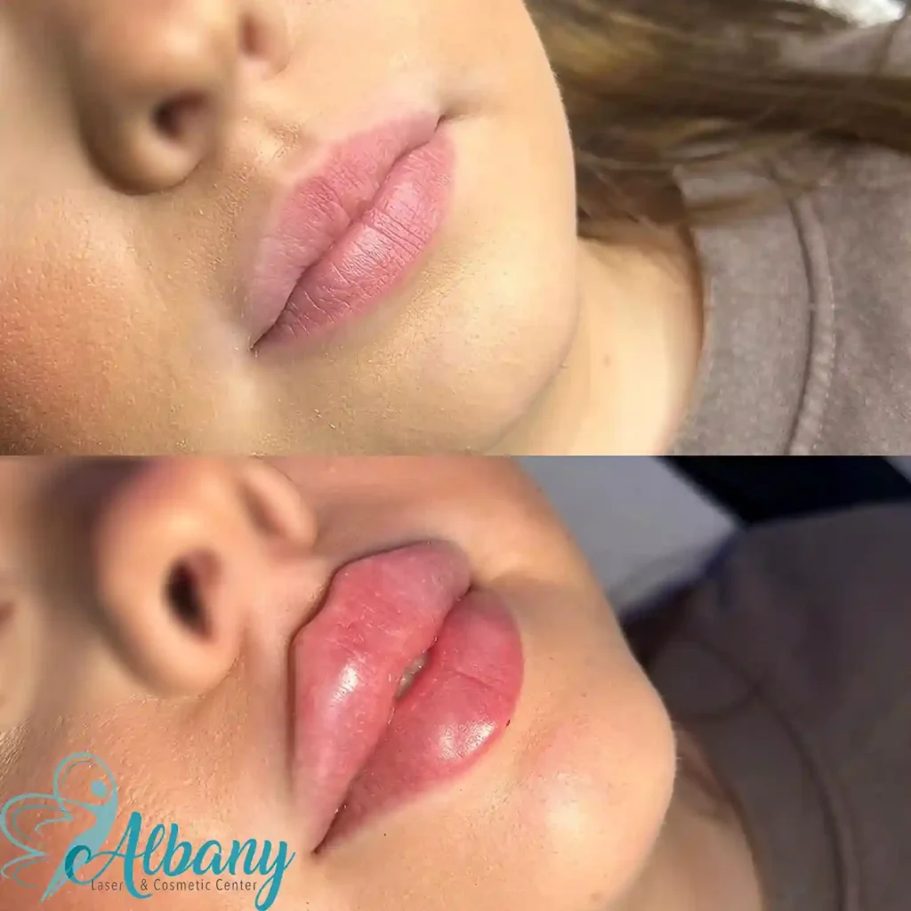 lips